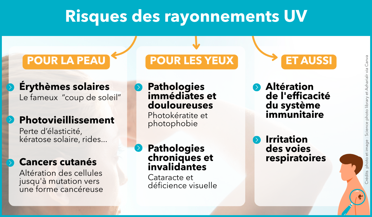 Risques des rayons ultraviolets pour la santé des travailleurs
