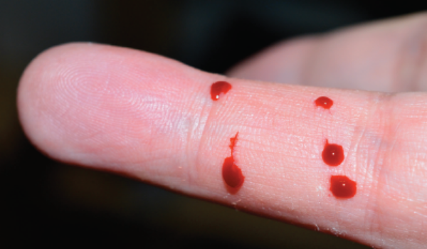 Risque viral Miniature AISMT13 Doigt qui saigne pour illustrer le risque viral
